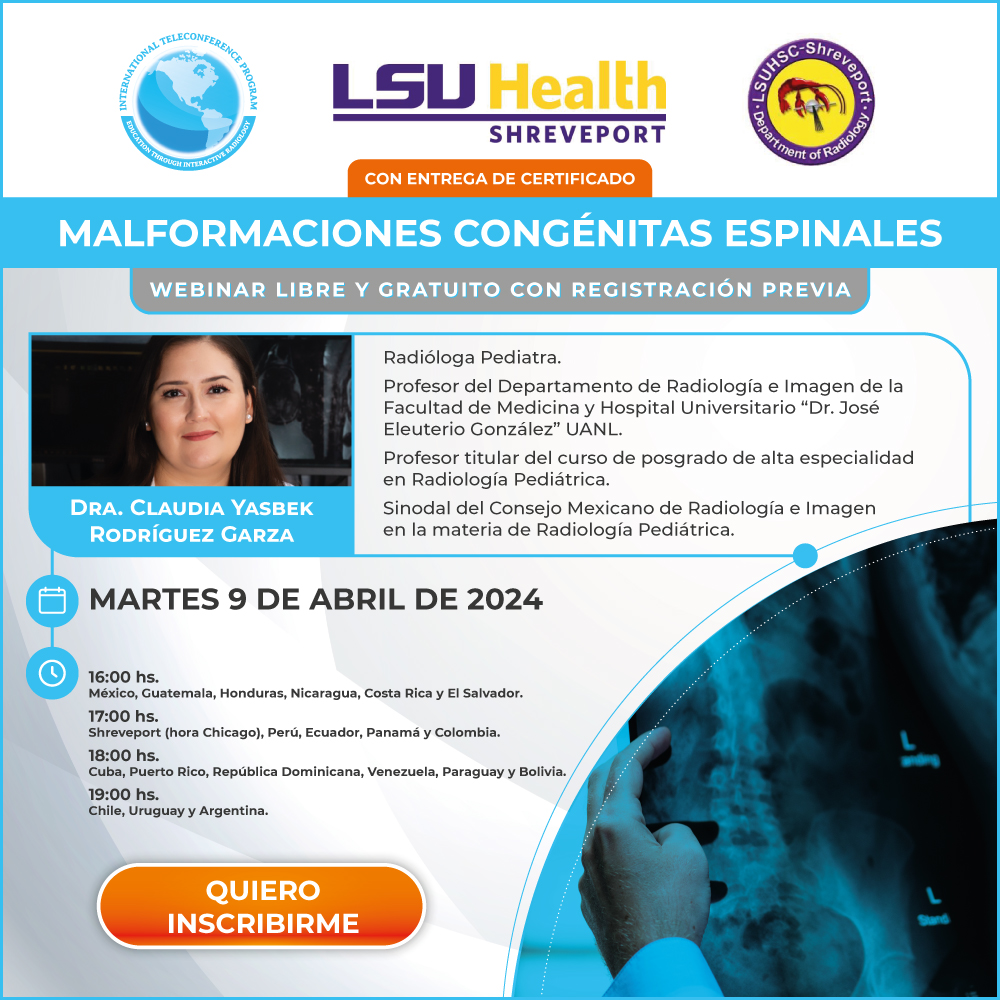 Webinar sobre Malformaciones Congénitas Espinales