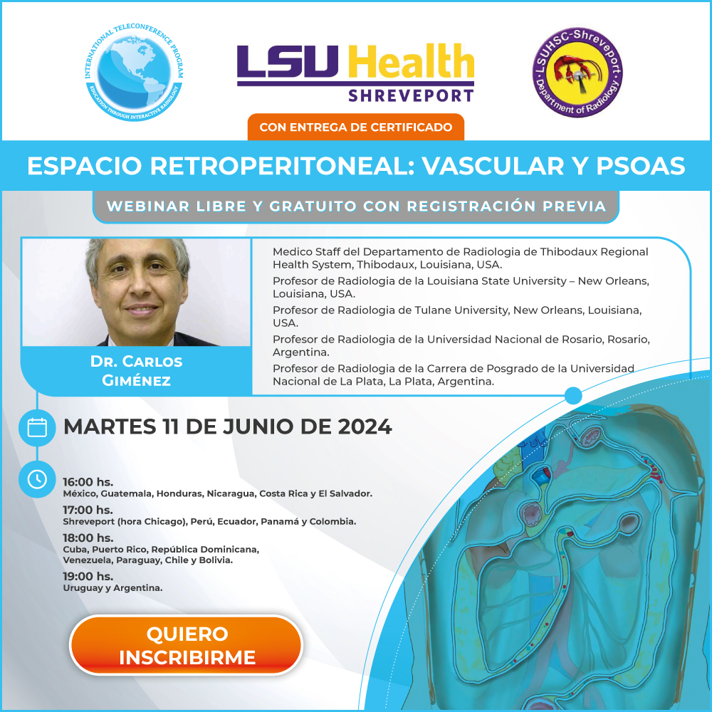 Webinar sobre Espacio Retroperitoneal: Vascular y Psoas