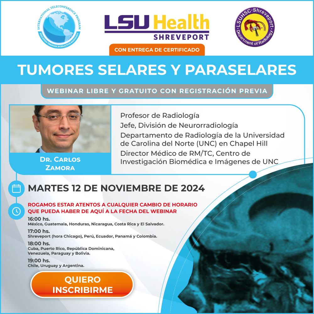 Webinar sobre Tumores Selares y Paraselares